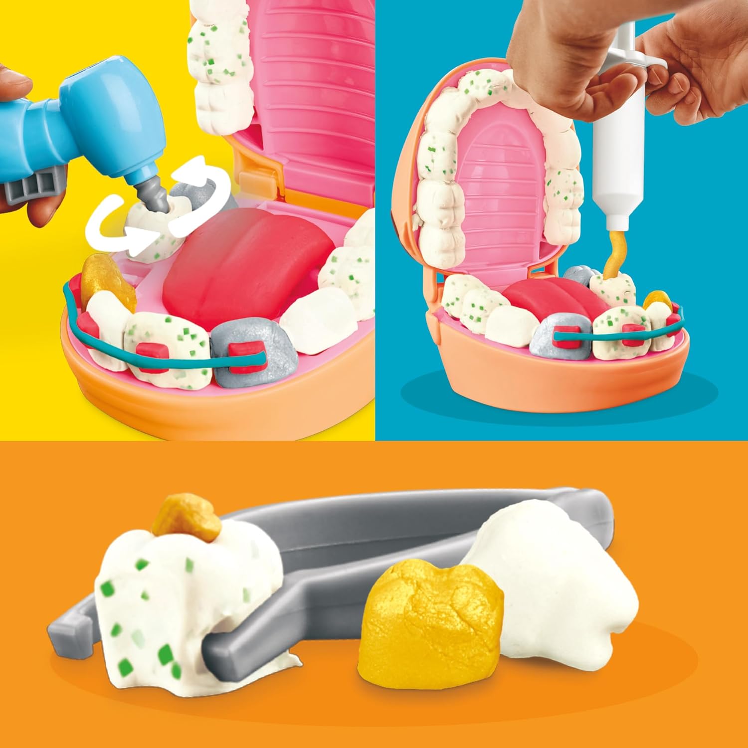 Play-Doh Drill ’n Fill Zahnarztspielzeug-Kinderspielset mit 10 Werkzeugen und 8 Dosen ab 3 Jahren